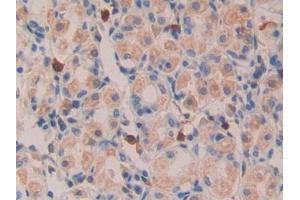 Detection of TGFa in Human Kidney Tissue using Polyclonal Antibody to Transforming Growth Factor Alpha (TGFa) (TGFA Antikörper  (AA 24-98))