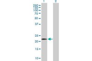 Western Blot analysis of COMMD10 expression in transfected 293T cell line by COMMD10 MaxPab polyclonal antibody. (COMMD10 Antikörper  (AA 1-202))