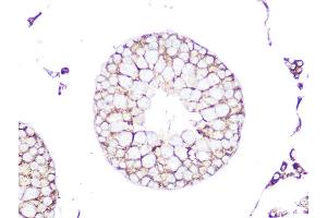Immunohistochemistry of paraffin-embedded rat testis using RHOA/RHOB/RHOC Rabbit mAb (ABIN1678636, ABIN3019244, ABIN3019245 and ABIN7101735) at dilution of 1:100 (40x lens). (RhoA,B,C Antikörper)