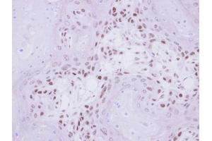 Immunohistochemistry (IHC) image for anti-Inositol Hexakisphosphate Kinase 1 (IP6K1) antibody (ABIN2855731)