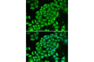 Immunofluorescence analysis of U2OS cell using TCL1A antibody. (TCL1A Antikörper)