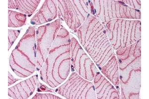 Human Skeletal Muscle: Formalin-Fixed, Paraffin-Embedded (FFPE) (ACTN2 Antikörper)