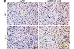 Inhibition of MBNL1-AS1 promoted the tumorigenesis of BC cells through the regulation of miR-135a/PHLPP2/FOXO1 in vivo. (Ki-67 Antikörper  (AA 700-800))