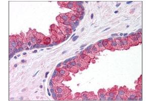 Human Prostate: Formalin-Fixed, Paraffin-Embedded (FFPE) (KLHL15 Antikörper  (C-Term))