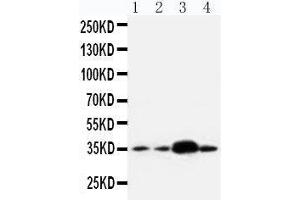 Anti-APE1 antibody, Western blotting Lane 1: U87 Cell Lysate Lane 2: A549 Cell Lysate Lane 3: SMMC Cell Lysate Lane 4: HELA Cell Lysate (APEX1 Antikörper  (Middle Region))