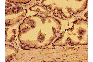 Immunohistochemistry of paraffin-embedded human prostate tissue using ABIN7159593 at dilution of 1:100