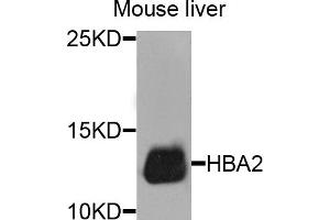 Western blot analysis of extracts of mouse liver, using HBA2 antibody.