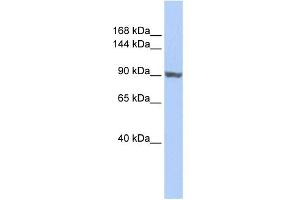 WB Suggested Anti-TNNI3K Antibody Titration:  0. (TNNI3K Antikörper  (Middle Region))