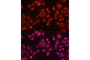 Immunohistochemistry of paraffin-embedded mouse testis using GALC antibody (ABIN1679950, ABIN3018222, ABIN3018224 and ABIN6220405) at dilution of 1:100 (40x lens). (GALC Antikörper  (AA 40-300))