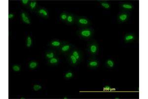Immunofluorescence of monoclonal antibody to TAF11 on HeLa cell. (TAF11 Antikörper  (AA 158-210))