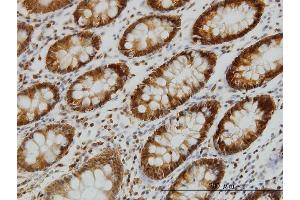 Immunostaining (ISt) image for anti-Erythrocyte Membrane Protein Band 4.1 (Elliptocytosis 1, RH-Linked) (EPB41) (AA 116-225) antibody (ABIN560752)
