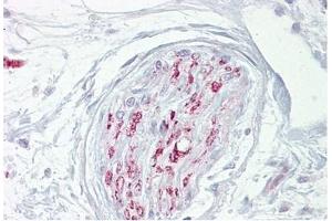 Nerve stained with CA2D1 Antibody in Immunohistochemistry on Paraffin Sections (CACNA2D1 Antikörper)