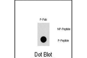 Dot blot analysis of Phospho-TSC2- polyclonal antibody (ABIN1881949 and ABIN2839674) on nitrocellulose membrane. (Tuberin Antikörper  (pSer1387))