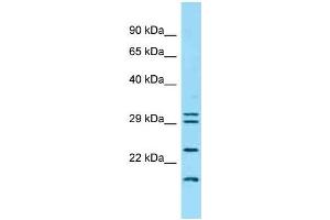 Western Blotting (WB) image for anti-Interferon, kappa (IFNK) (C-Term) antibody (ABIN2789152)