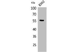 Western Blot analysis of K562 cells using Glut5 Polyclonal Antibody. (SLC2A5 Antikörper  (N-Term))
