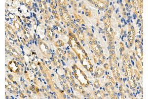 ABIN6264163 and ABIN6278507 at 1/100 staining Rat kidney tissue by IHC-P.
