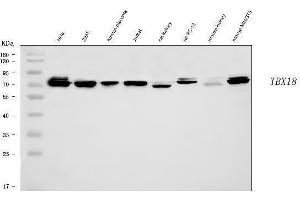 Western blot analysis of TBX18 using anti-TBX18 antibody (ABIN7599494).