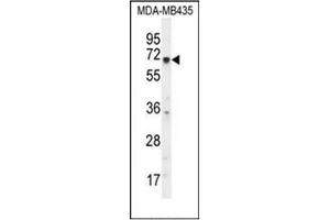 Western blot analysis of KCNQ1 Antibody (N-term) in MDA-MB435 cell line lysates (35ug/lane). (KCNQ1 Antikörper  (N-Term))