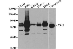 Western Blotting (WB) image for anti-Asparagine Synthetase (ASNS) antibody (ABIN1876738) (Asparagine Synthetase Antikörper)