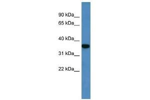 Western Blot showing Decr2 antibody used at a concentration of 1-2 ug/ml to detect its target protein. (DECR2 Antikörper  (C-Term))
