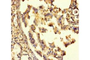 Immunohistochemistry (IHC) image for anti-gamma-aminobutyric Acid (GABA) A Receptor, alpha 6 (GABRA6) (AA 20-242) antibody (ABIN7153489)