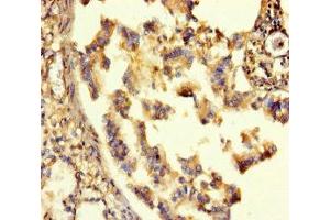 Immunohistochemistry of paraffin-embedded human lung tissue using ABIN7153489 at dilution of 1:100 (GABRA6 Antikörper  (AA 20-242))