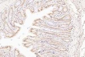 Immunohistochemistry analysis of paraffin-embedded rat colon using,TORC1 (ABIN7073590) at dilution of 1: 800
