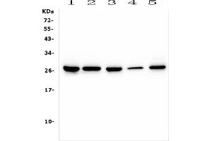 Western blot analysis of CD160 using anti-CD160 antibody (ABIN6719459). (CD160 Antikörper  (AA 27-159))