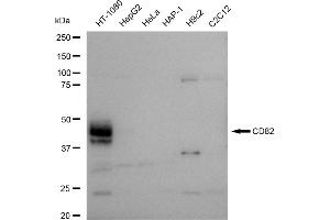 Western blotting analysis using CD82 antibody (ABIN7797982). (Rekombinanter CD82 Antikörper)