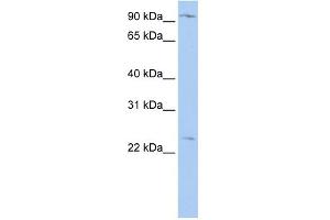 WB Suggested Anti-OSBPL8 Antibody Titration:  0. (OSBPL8 Antikörper  (N-Term))