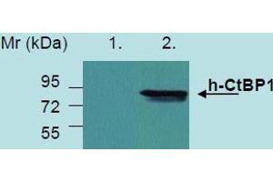 Western Blotting analysis of recombinant protein h-CtBP1 produced in HEK 293 transfected cells. (CTBP1 Antikörper)