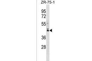 PCMTD2 Antibody (C-term) (ABIN1536944 and ABIN2849981) western blot analysis in ZR-75-1 cell line lysates (35 μg/lane). (PCMTD2 Antikörper  (C-Term))