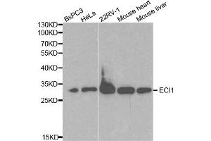 Western blot analysis of extracts of various cell lines, using ECI1 antibody. (DCI Antikörper)
