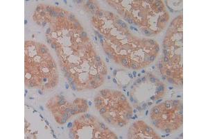 Used in DAB staining on fromalin fixed paraffin- embedded Kidney tissue (LAMC2 Antikörper  (AA 28-196))
