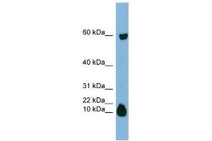 STATH antibody used at 1 ug/ml to detect target protein. (STATH Antikörper  (Middle Region))