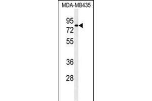 Western blot analysis of ATHL1 Antibody (C-term) (ABIN1881084 and ABIN2840111) in MDA-M cell line lysates (35 μg/lane). (ATHL1 Antikörper  (C-Term))