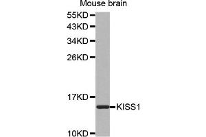 Western blot analysis of extracts of mouse brain, using KISS1 antibody (ABIN5971535). (KISS1 Antikörper)