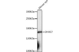 Western blot analysis of extracts of mouse eye, using DHX57 antibody (ABIN7266707) at 1:1000 dilution. (DHX57 Antikörper  (AA 700-900))