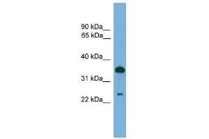 TPD52 antibody used at 0. (TPD52 Antikörper  (C-Term))
