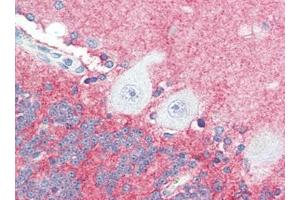 Human Brain, Cerebellum (formalin-fixed, paraffin-embedded) stained with SLITRK2at 5 µg/ml followed by biotinylated goat anti-rabbit IgG secondary antibody, alkaline phosphatase-streptavidin and chromogen. (SLITRK2 Antikörper  (C-Term))