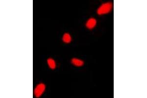 Immunofluorescent analysis of CHK2 staining in HL60 cells. (CHEK2 Antikörper  (N-Term))