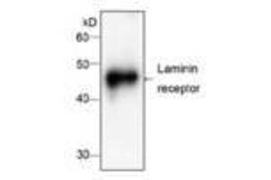 Image no. 1 for anti-Ribosomal Protein SA (RPSA) antibody (ABIN791537) (RPSA/Laminin Receptor Antikörper)