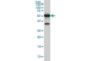 ROD1 monoclonal antibody (M01), clone 4C9 Western Blot analysis of ROD1 expression in Hela S3 NE . (PTBP3 Antikörper  (AA 16-114))