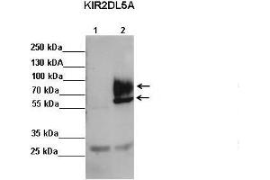 Sample Type: Lane 1: FALG IP'd FLAG-KIR2DL4 transfected NK92 cells Lane 2: FALG IP'd FLAG-KIR2DL5 transfected NK92 cells Primary Antibody Dilution: 1:500Secondary Antibody: Anti-rabbit-HRP Secondary Antibody Dilution: 1:00,000 Color/Signal Descriptions: KIR2DL5A  Gene Name: Kerry S. (KIR2DL5A Antikörper  (C-Term))