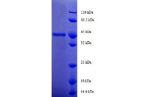 SDS-PAGE (SDS) image for GM2 Ganglioside Activator (GM2A) (AA 32-193) protein (GST tag) (ABIN5712219)