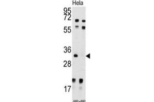 Western Blotting (WB) image for anti-Uridine-Cytidine Kinase 2 (UCK2) antibody (ABIN3003032) (UCK2 Antikörper)