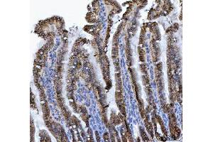IHC analysis of LI Cadherin/CDH17 using anti-LI Cadherin/CDH17 antibody (ABIN7600855).