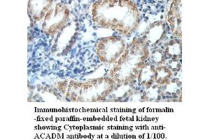 Image no. 1 for anti-Medium-Chain Specific Acyl-CoA Dehydrogenase, Mitochondrial (MCAD) antibody (ABIN791208) (Medium-Chain Specific Acyl-CoA Dehydrogenase, Mitochondrial (MCAD) Antikörper)