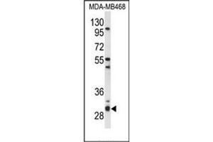 Western Blotting (WB) image for anti-Proteasome (Prosome, Macropain) Assembly Chaperone 2 (PSMG2) (AA 224-253), (C-Term) antibody (ABIN954357)