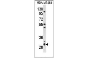 Western blot analysis of PSMG2 Antibody (C-term) in MDA-MB468 cell line lysates (35ug/lane). (PSMG2 Antikörper  (C-Term))